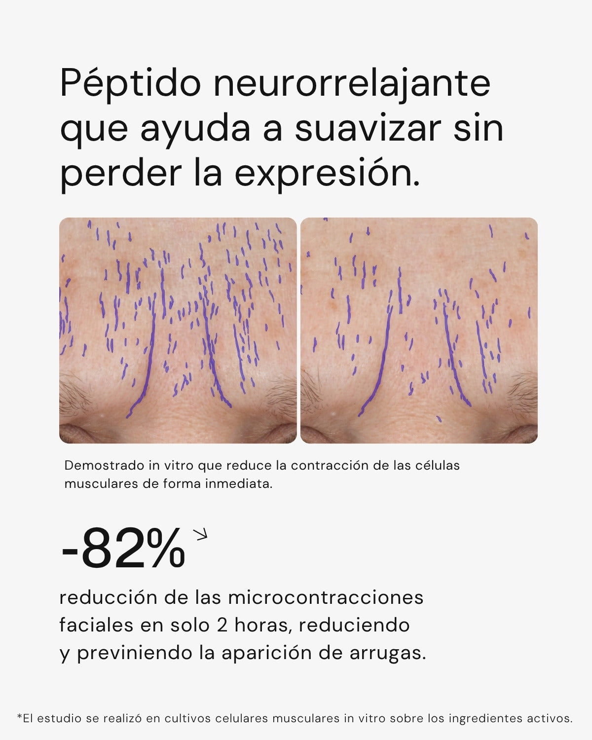 Serum Ultra Rejuvenecedor EXO-PDRN