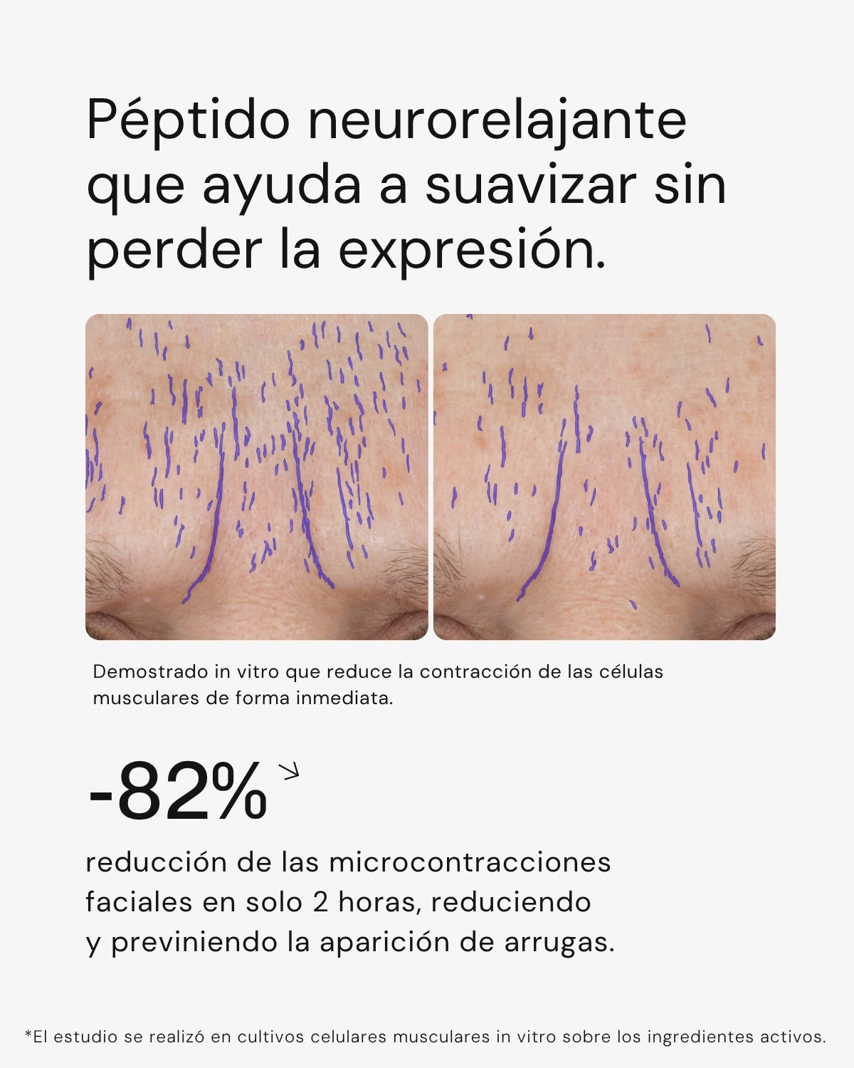 Serum Ultra Rejuvenecedor EXO-PDRN