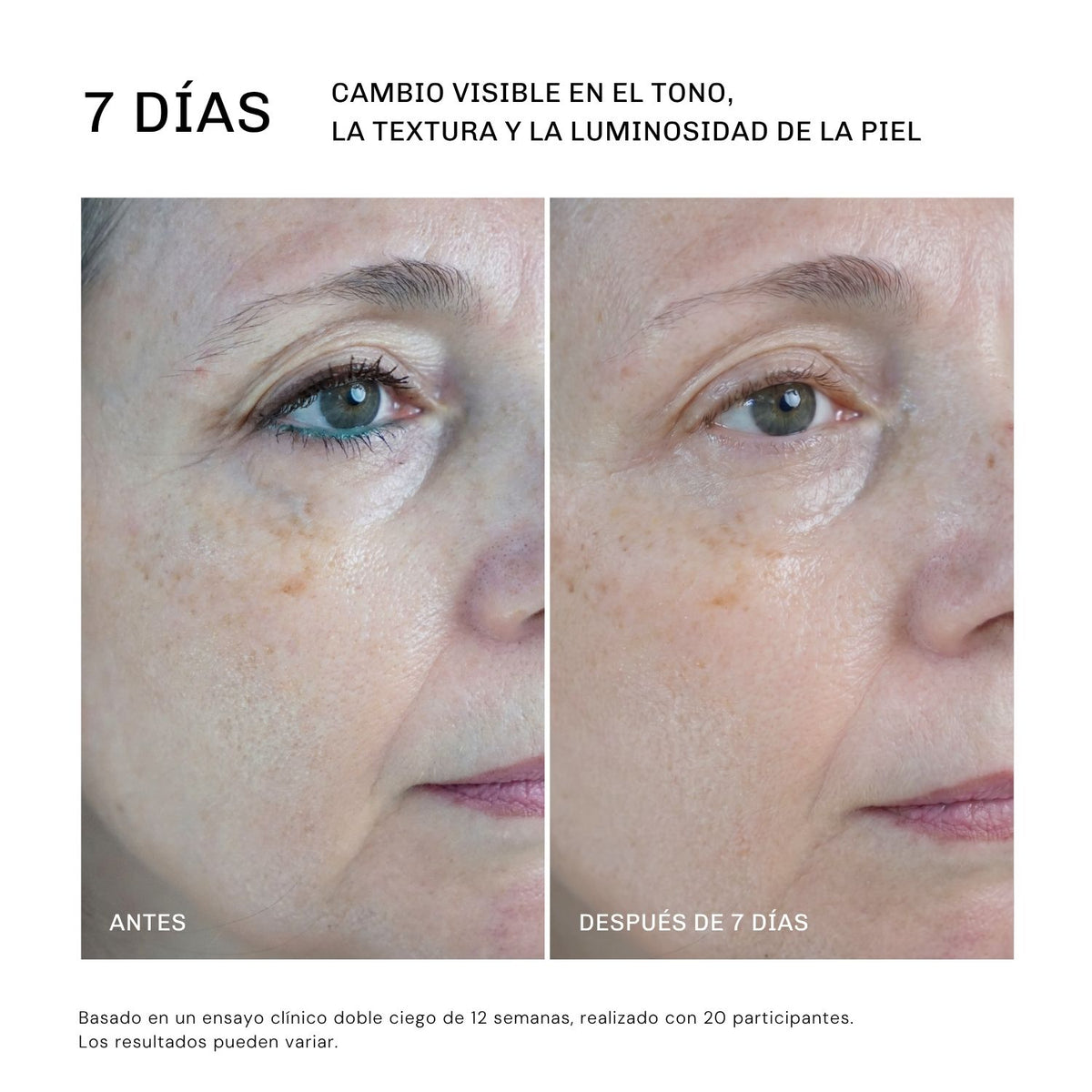 Serum Ultra Rejuvenecedor EXO-PDRN