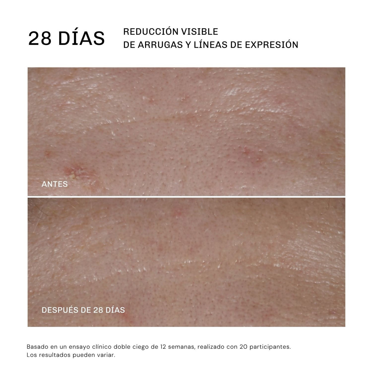 Serum Ultra Rejuvenecedor EXO-PDRN