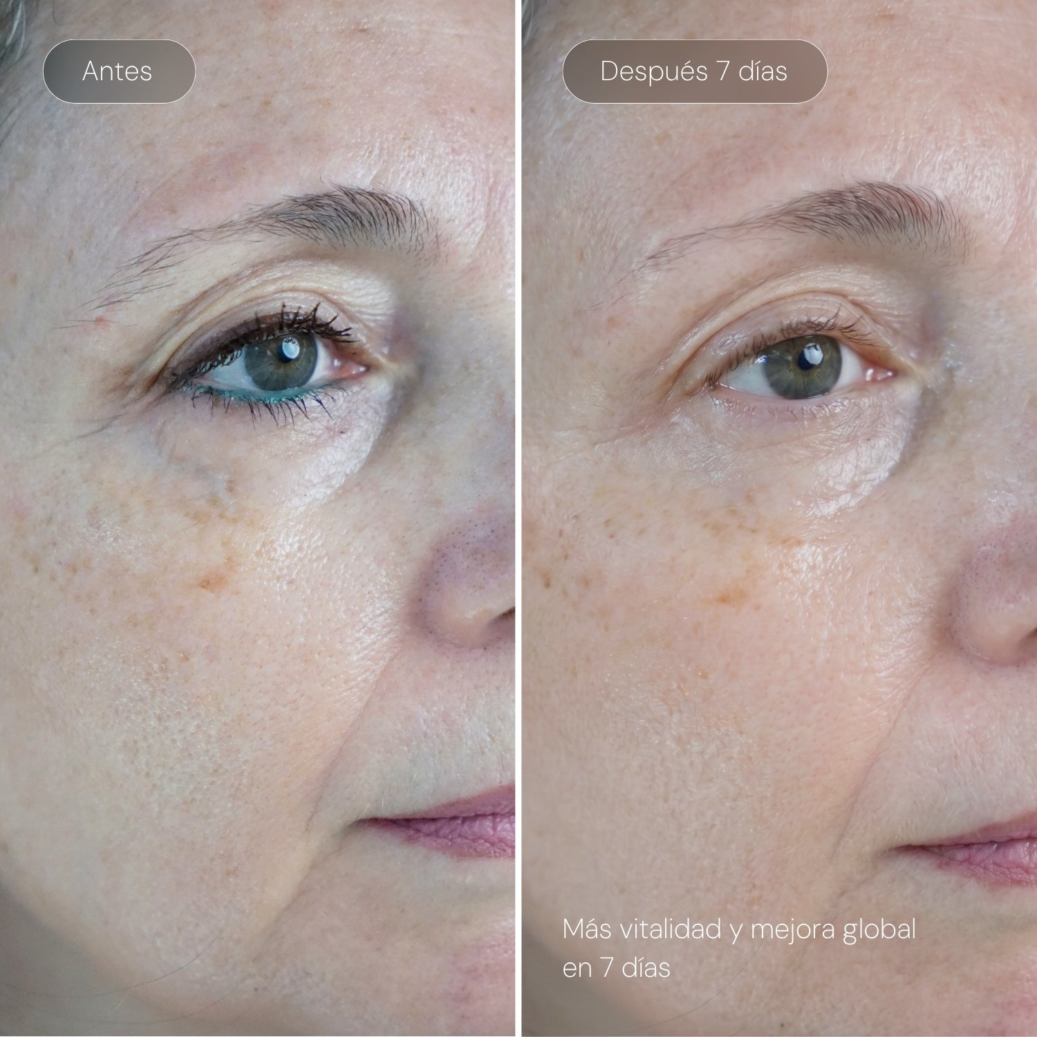 Serum Ultra Rejuvenecedor EXO-PDRN
