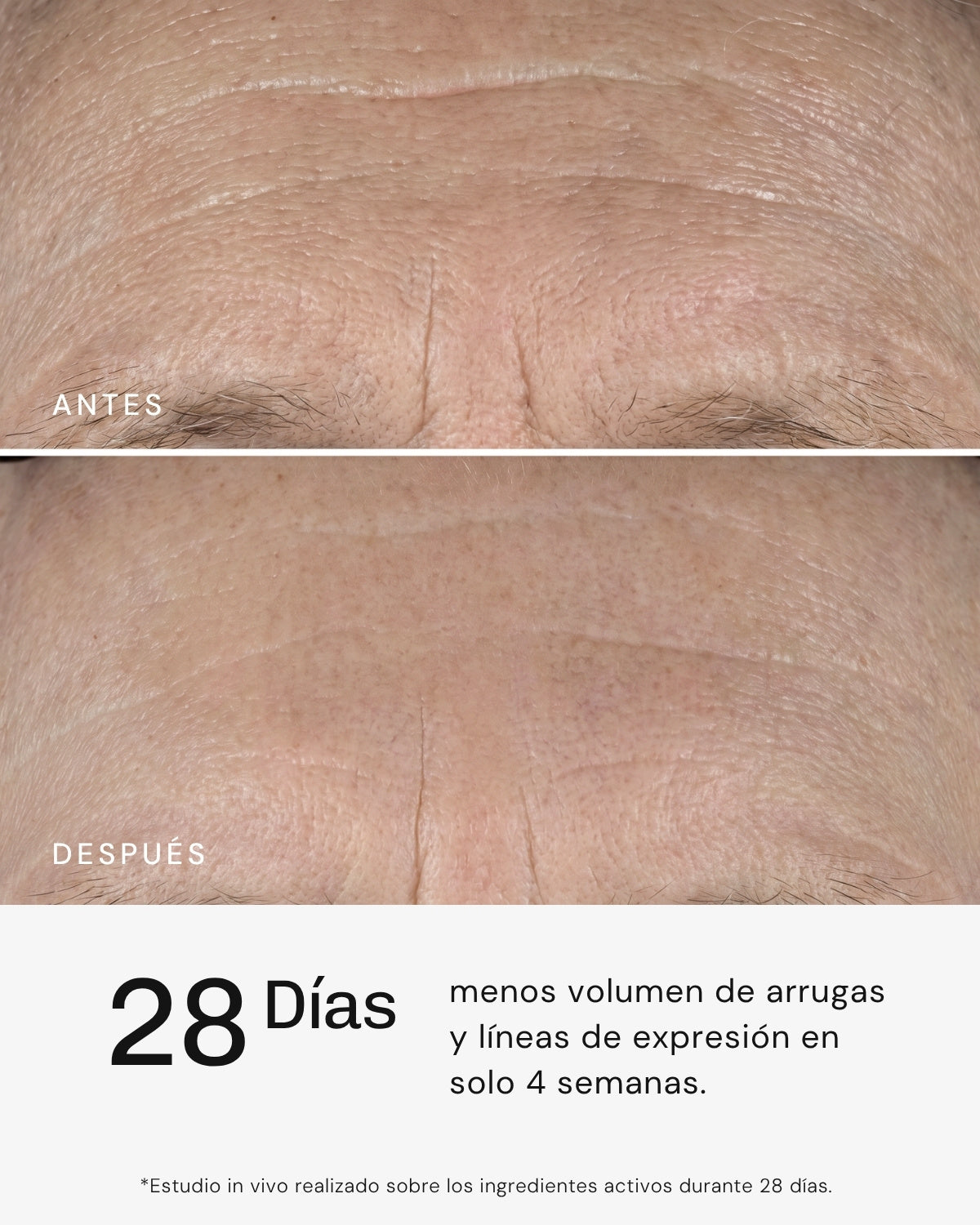 Serum Ultra Rejuvenecedor EXO-PDRN