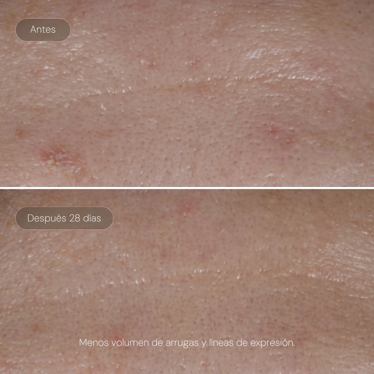 Serum Ultra Rejuvenecedor EXO-PDRN