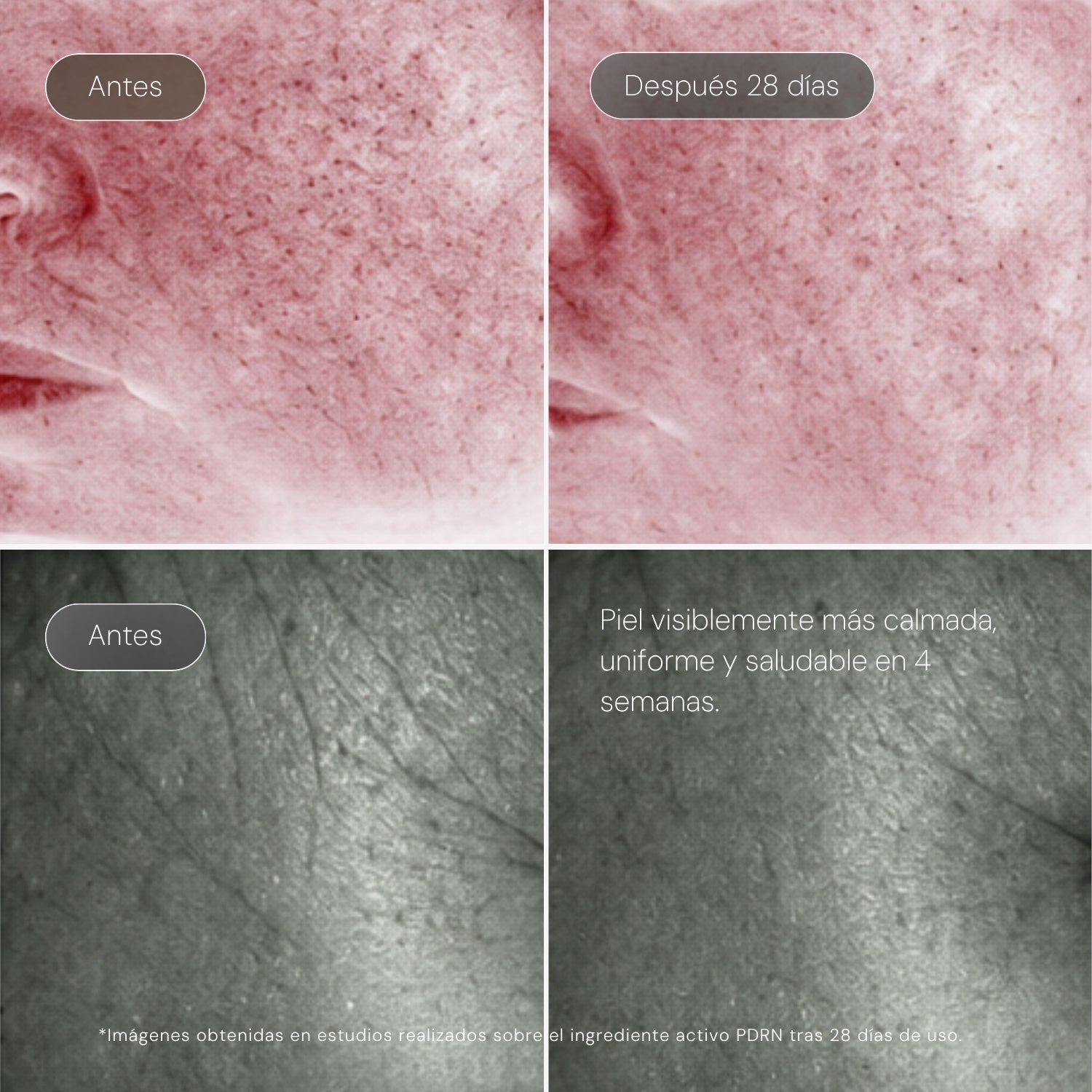 Serum Ultra Rejuvenecedor EXO-PDRN